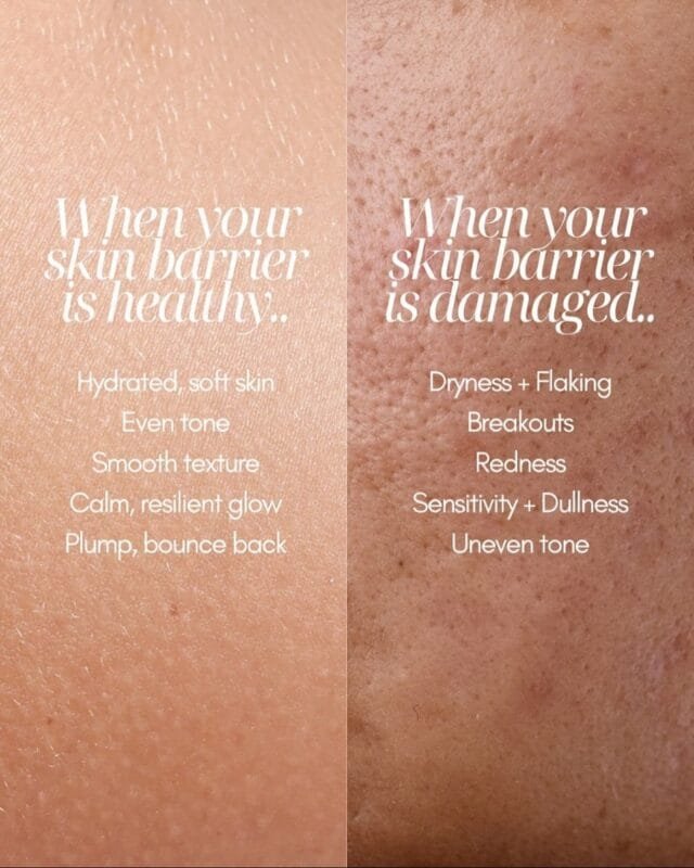 Comparison of healthy skin vs damaged skin barrier showing redness, flaking, and uneven texture.